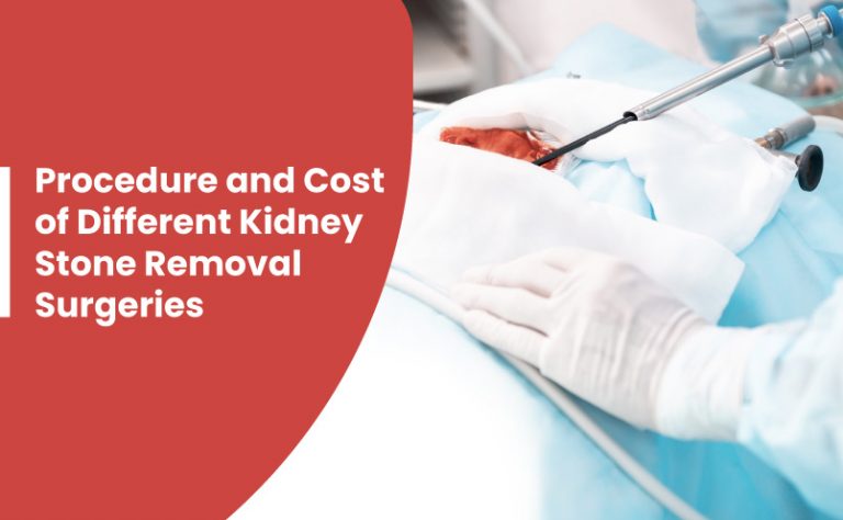 procedure-cost-of-different-kidney-stone-removal-surgeries